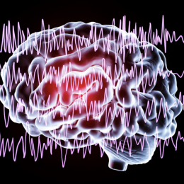 An image of brain waves emblematic of generalized epilepsy.